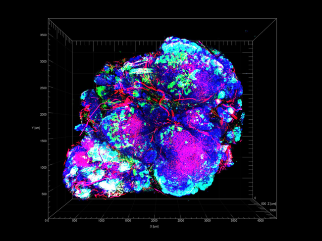 Transparent tumor tomography image of a mouse model for HER2-positive breast cancer.