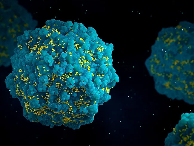 HIV particles emerging from an infected T cell