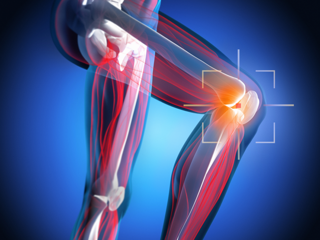 Illustration of leg anatomy with target around knee