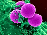 Microscopic image of Methicillin-resistant S. aureus.