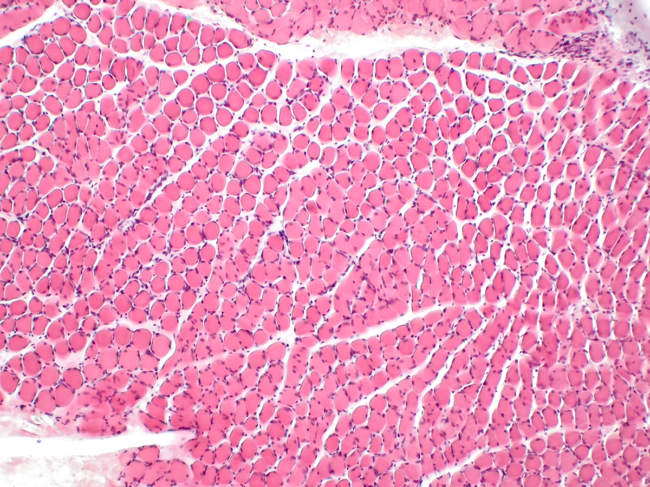 Light micrograph of skeletal muscle.