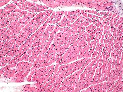 Musculoskeletal skeletal muscle fiber