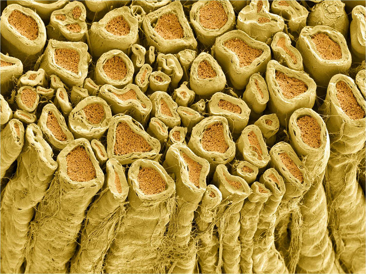 Myelinated axons in a rat spinal root. 