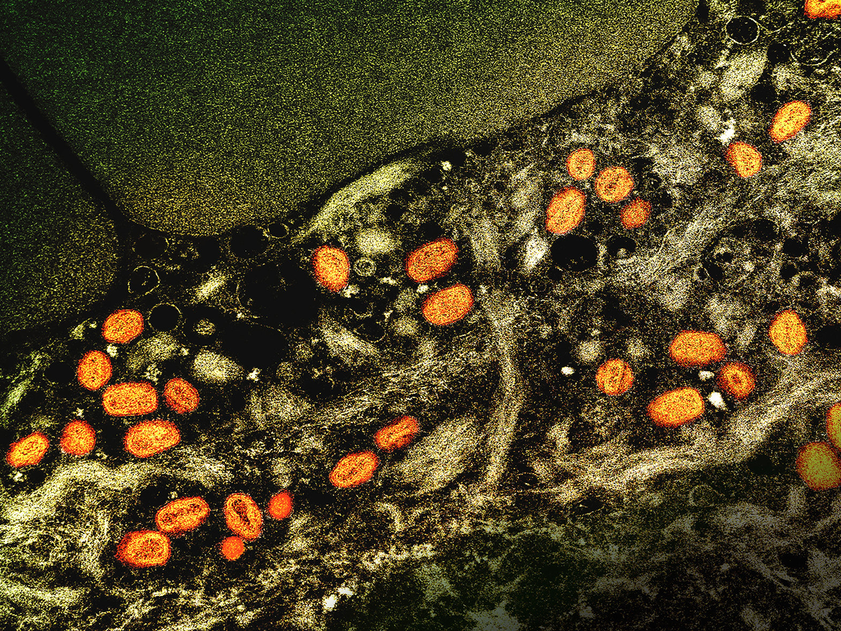 Colorized transmission electron micrograph of mpox virus particles found within an infected cell.