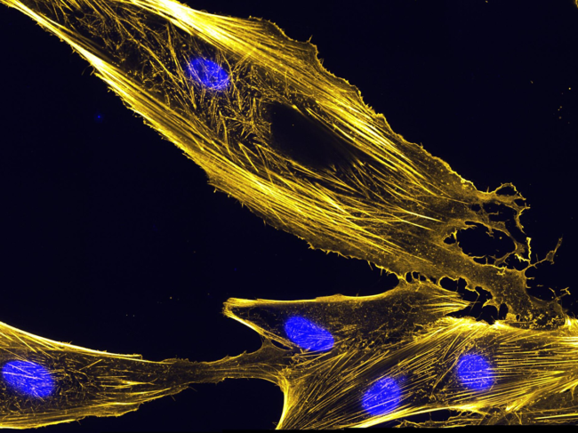 Microscopic image of cytoskeletons.