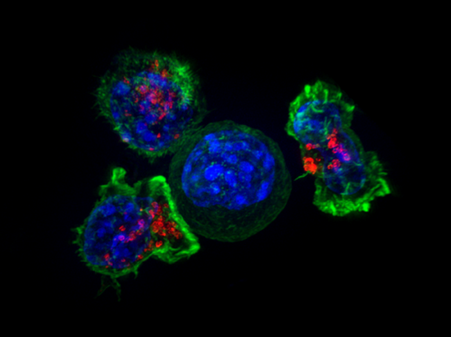 Killer T cells surround a cancer cell.