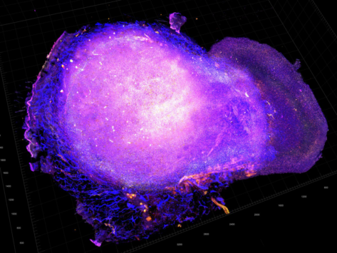 Tumor microenvironment of mouse model for HER2-positive breast cancer.