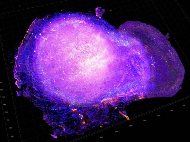 Tumor microenvironment of mouse model for HER2-positive breast cancer.