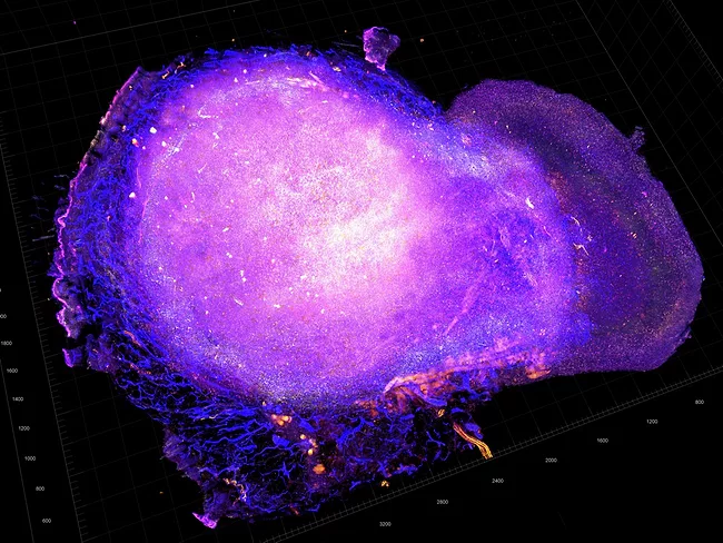 Tumor microenvironment of mouse model for HER2-positive breast cancer.
