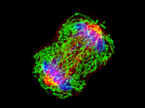 Dividing breast cancer cell.