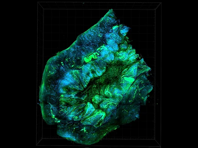 Mouse model of ovarian cancer.