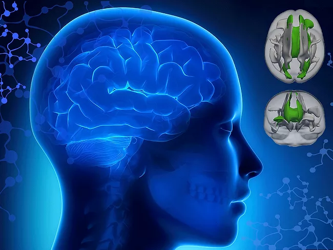 Attention deficit hyperactivity disorder brain connections illustration.