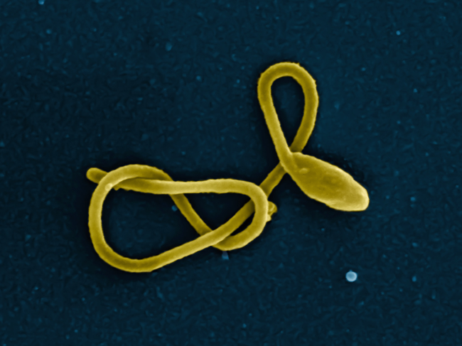 Colorized scanning electron micrograph of a single filamentous Ebola virus particle.