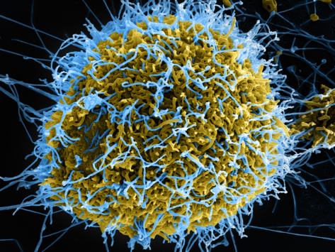 Colorized scanning electron micrograph of Ebola virus.