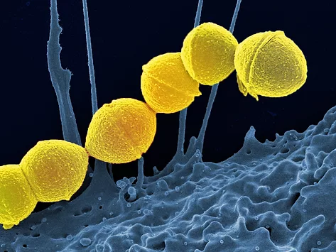 Microscopic image of Group A streptococcus bacteria.