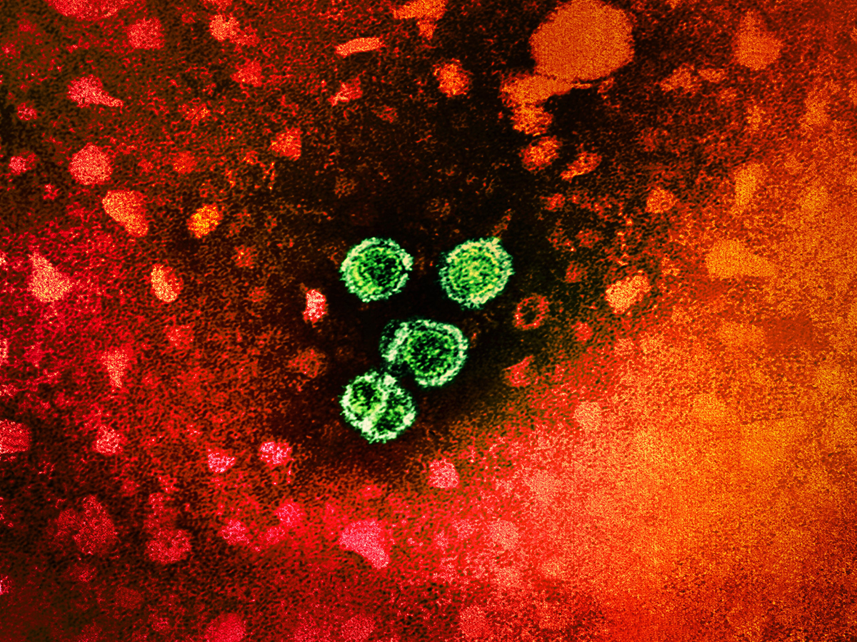 Transmission electron micrograph of hepatitis B virus particles