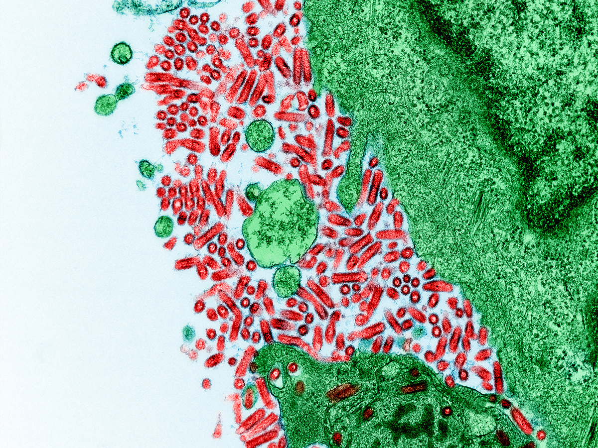 Colorized transmission electron micrograph of rabies virus.