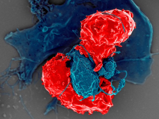Colorized scanning electron microscope image of regulatory T cells and antigen-presenting cells.