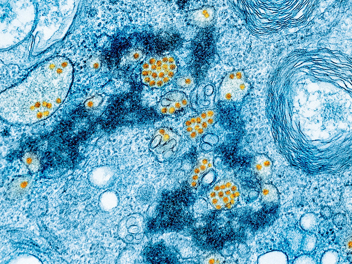 Colorized transmission electron micrograph of yellow fever virus particles.