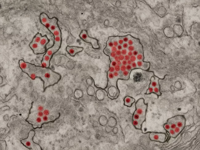 Zika virus particles.