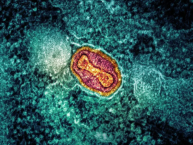 Colorized transmission electron micrograph of an mpox virus particle