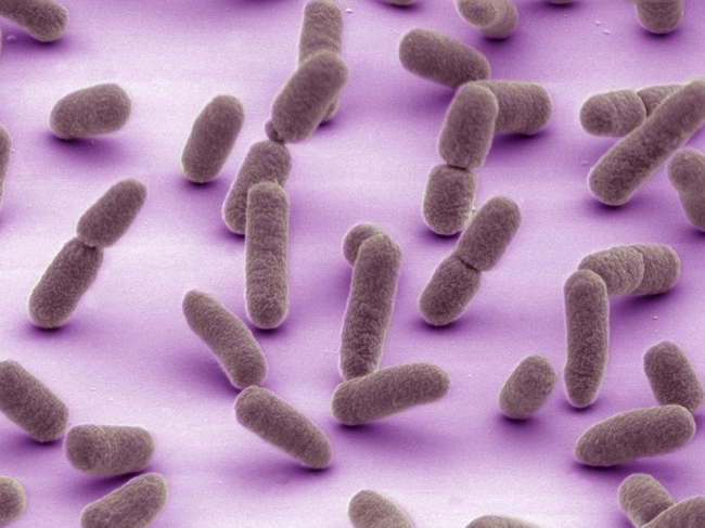Electron microscopy of E. coli bacteria.