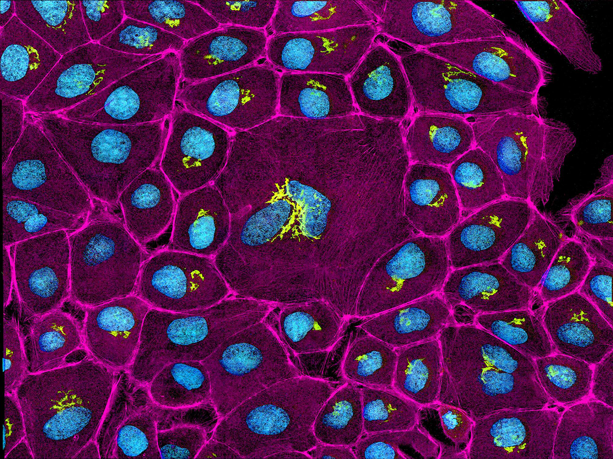Colorized epithelial cells.