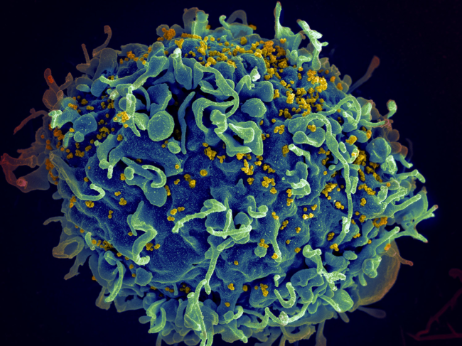 Human T cell under attack by HIV.