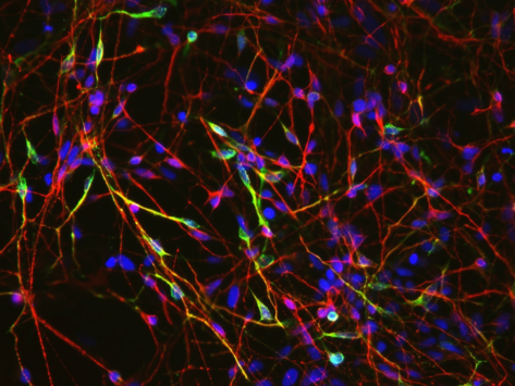 Neurons derived from human embryonic stem cells.