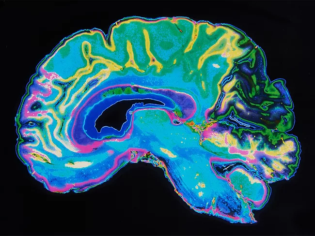 MRI image brain on black background