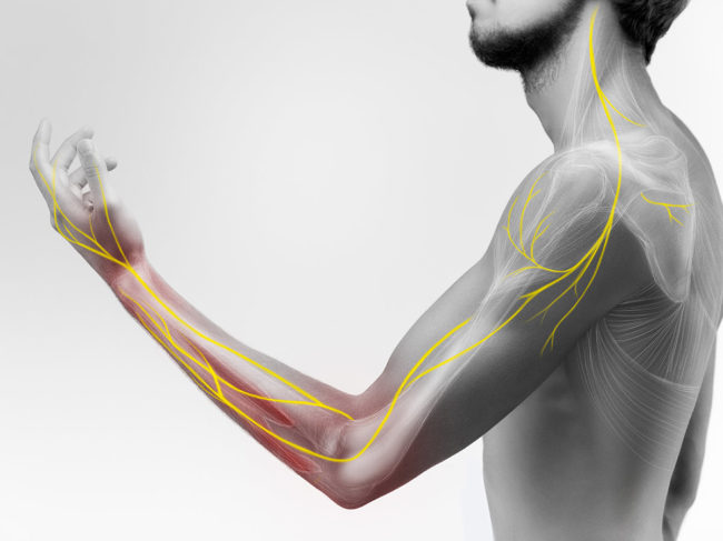 Man holding raised arm with illustrated overlay of nerves