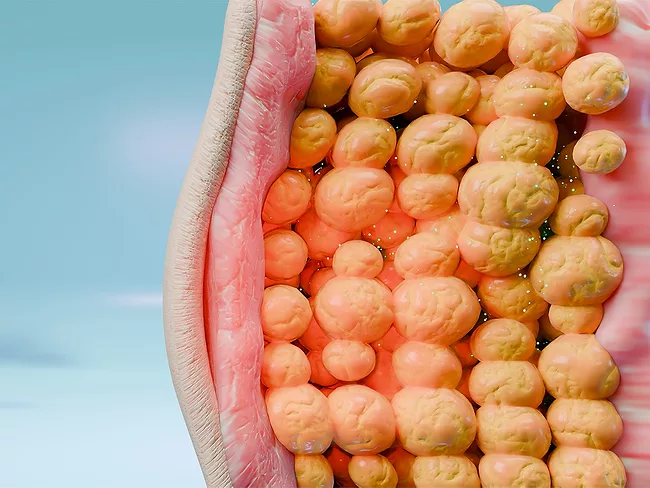 Illustration of adipose tissue under the skin