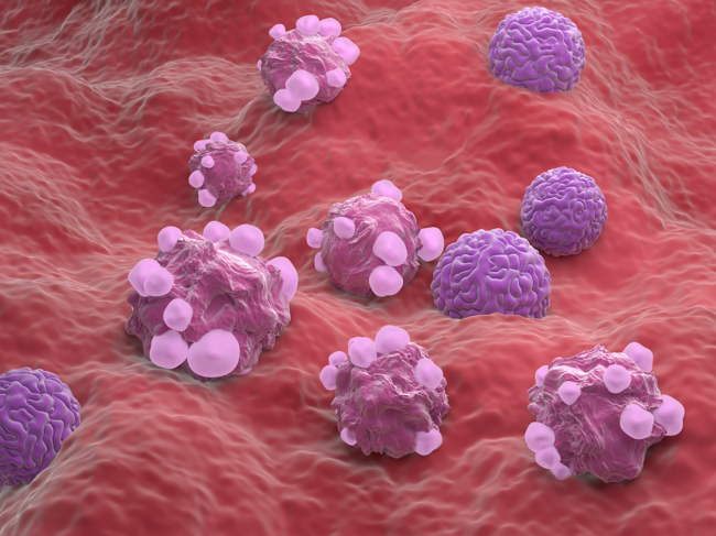 3D illustration of ovarian cancer cells.