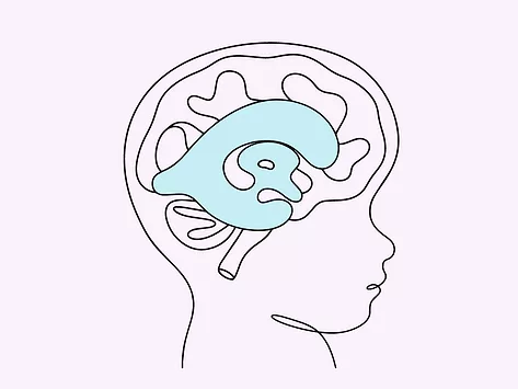 Pediatric hydrocephalus neurology brain swell
