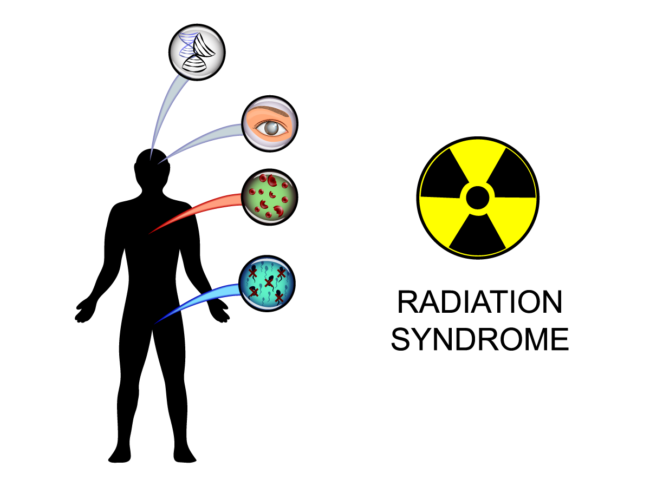 Concept image for radiation syndrome