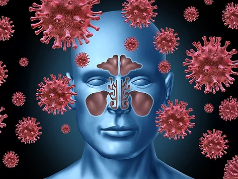 Sinus infection illustration