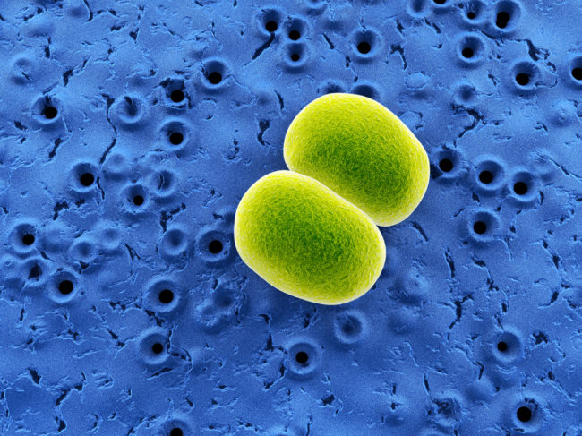 Staphylococcus epidermidis under microscope