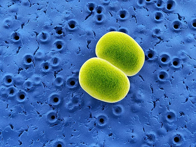 Staphylococcus epidermidis under microscope