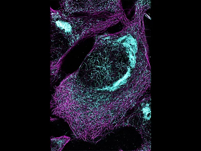 Tau protein in cell model of tauopathy