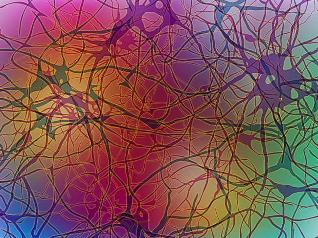 Multiple sclerosis, neurons concept art.