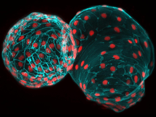 Zebrafish heart muscle cells.