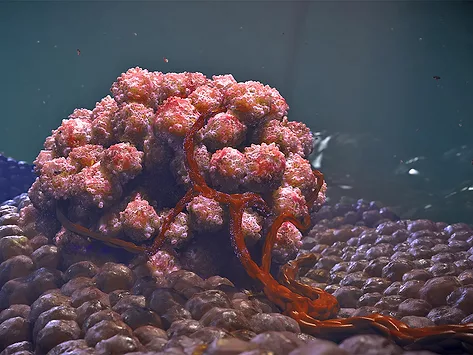 Illustration of tumor