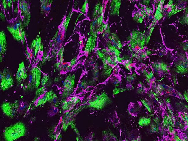 Cerebral small vessel disease under the microscope