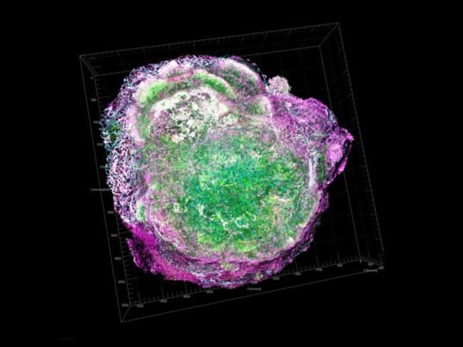 Microenvironment of a HER2-expressing breast tumor 