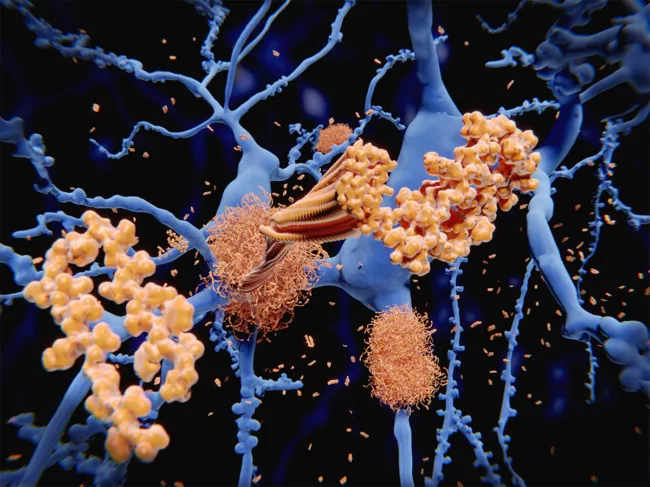 Amyloid beta peptides on neurons