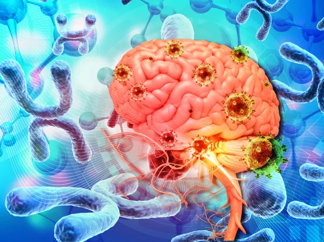 Brain and virus with chromosome