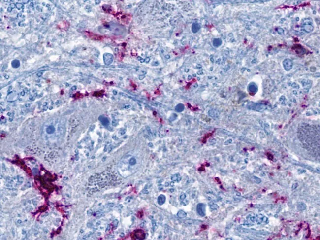 Cross section of brainstem