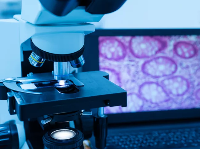 Microscope with laptop displaying histology image.