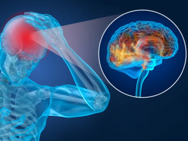 Man holding head in pain, brain inset
