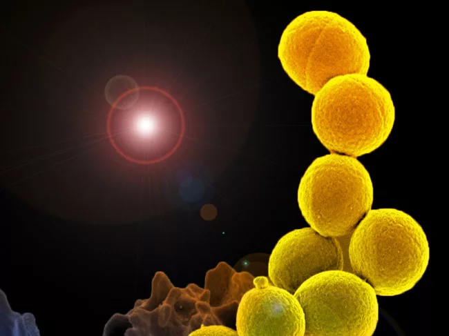 Methicillin-resistant S. aureus (MRSA)